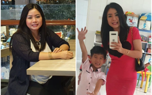 Foto dr. Okta sebelum dan sesudah combine treatment selama 4 bulan berat badan turun 15 Kg. (Foto: ABL)