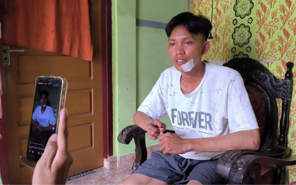 Thumbnail Berita - Motor Nyaris Dirampas, Pemuda Ini Jadi Korban Begal di Pakjo Palembang