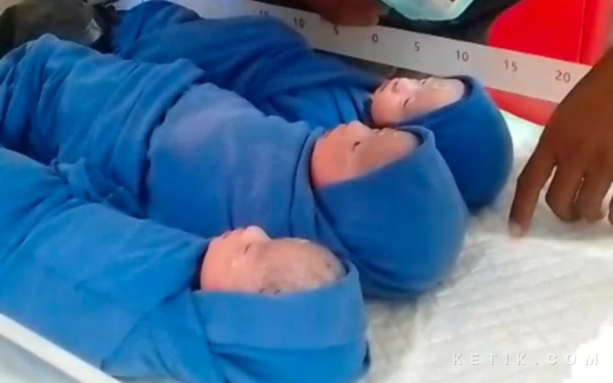 Thumbnail Berita - Bayi Kembar Tiga Lahir di Bangkalan, Jadi Kado Istimewa di Hari Kartini